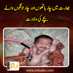 Child born with 4 hands and 4 legs